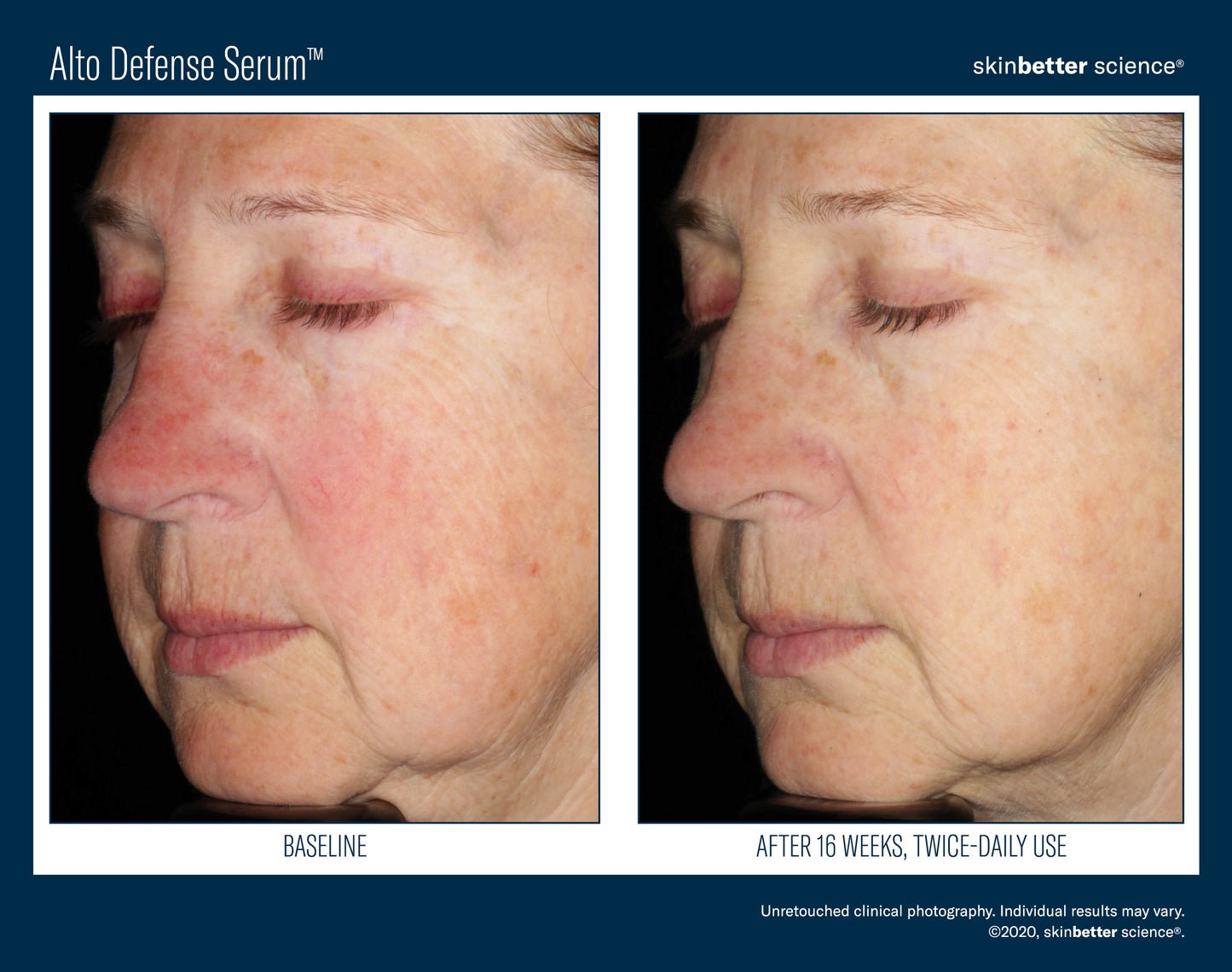 SkinBetter Science Alto Advanced Defense and Repair Serum 30ml