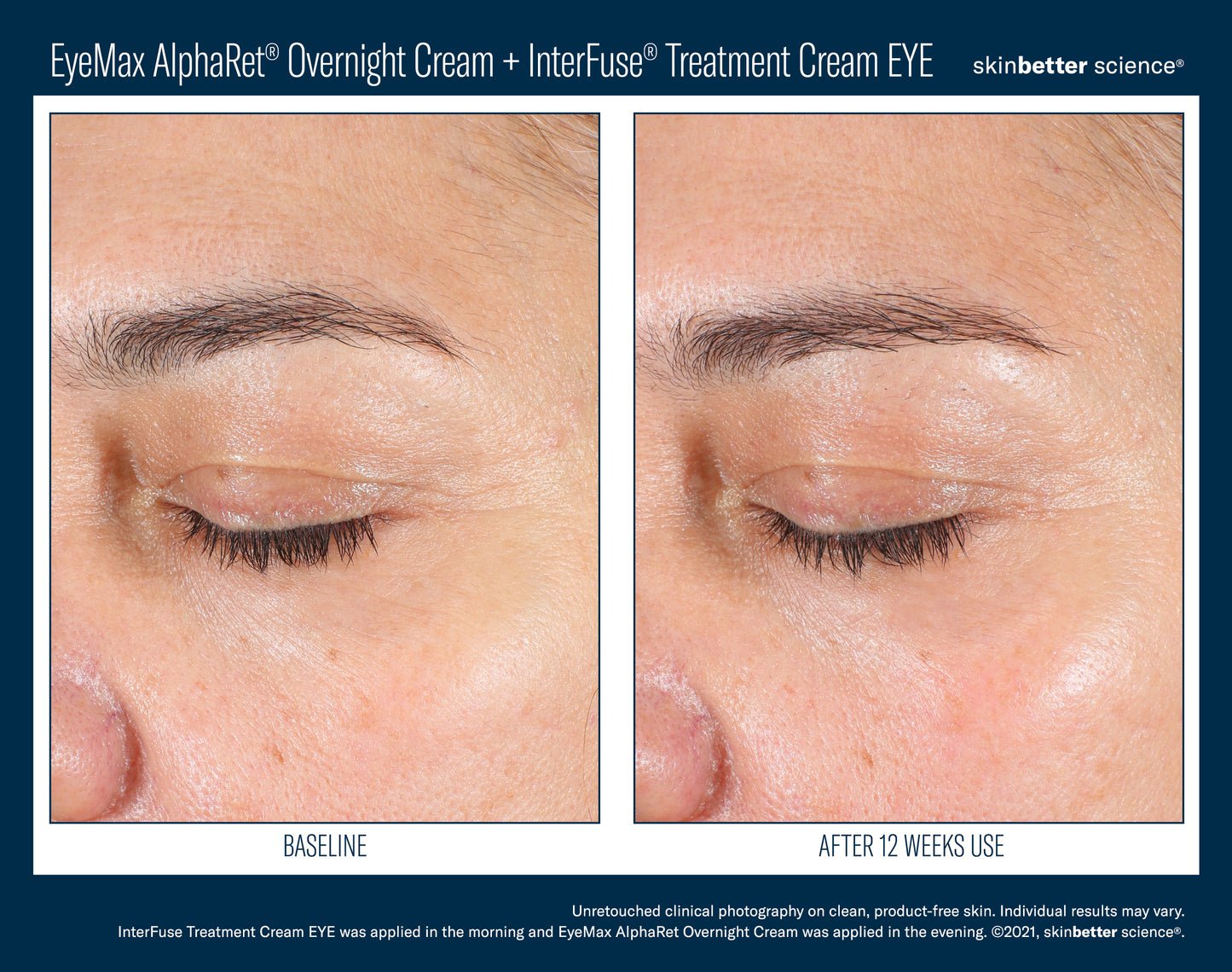 SkinBetter Science EYEMAX ALPHARET 15ML