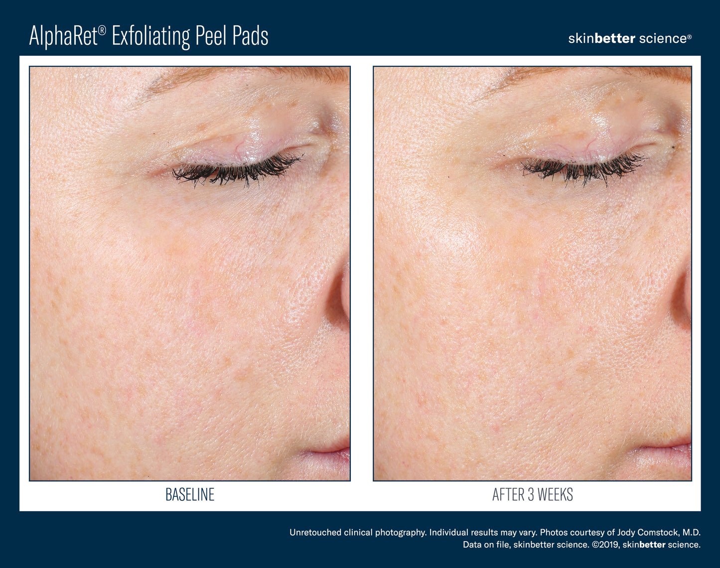 SkinBetter Science ALPHARET PEEL PADS 30CT