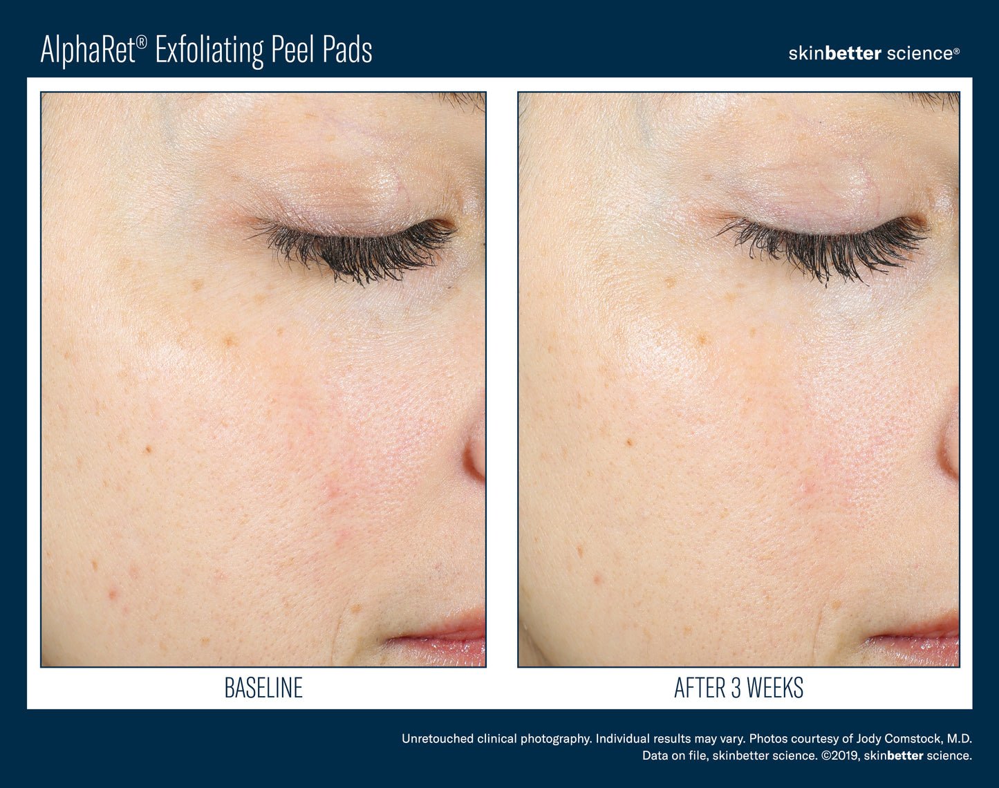 SkinBetter Science ALPHARET PEEL PADS 30CT